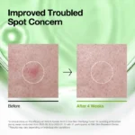 ANUA Azelaic Acid 3 Cica Skin Clarifying Toner 250ml - Image 7