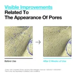 ANUA BHA 2 Gentle Exfoliating Toner 150ml - Image 4