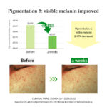 Dr. Althea Gentle Vitamin C Serum 30ml - Image 11