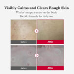 Medicube Red Acne Body Peeling Shot 2.0 110g - Image 4