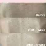 Medicube Red Acne Body Wash 2.0 400g - Image 18