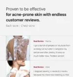 Medicube Red Acne Body Wash 2.0 400g - Image 5